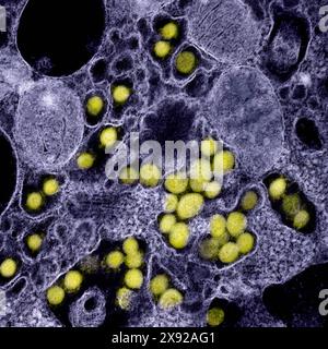 Micrographie électronique en transmission des particules du virus SARS-CoV-2 isolées d'un patient. Image capturée et rehaussée de couleurs au NIAID Integrated Research Facility IRF à Fort Detrick, Maryland. Nouveau coronavirus SARS-CoV-2 016546 023 Banque D'Images