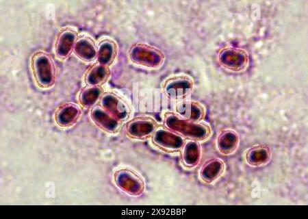 Pneumocoque Streptococcus pneumoniae, pneumocoque est une bactérie impliquée dans la pneumonie, la bronchopneumonie, la pleurésie purulente, la méningite bactérienne, l'otite, sinusite et conjonctivite. Image produite par microscopie optique. Pneumocoque 016813 025 Banque D'Images