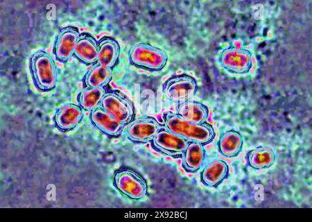 Pneumocoque Streptococcus pneumoniae, pneumocoque est une bactérie impliquée dans la pneumonie, la bronchopneumonie, la pleurésie purulente, la méningite bactérienne, l'otite, sinusite et conjonctivite. Image produite par microscopie optique. Pneumocoque 016813 027 Banque D'Images