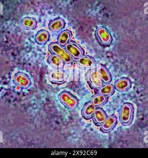 Pneumocoque Streptococcus pneumoniae, pneumocoque est une bactérie impliquée dans la pneumonie, la bronchopneumonie, la pleurésie purulente, la méningite bactérienne, l'otite, sinusite et conjonctivite. Image produite par microscopie optique. Pneumocoque 016813 030 Banque D'Images