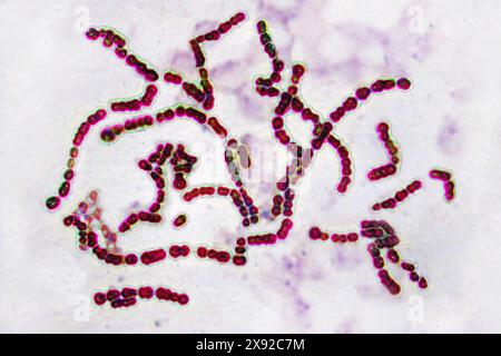 Streptocoques pyogenes du groupe A. Elle est la cause d'infections cutanées impétigo, abcès, infections bronchopulmonaires, une forme de mal de gorge qui peut se développer en complications telles que le rhumatisme articulaire aigu. Image produite par microscopie optique. Streptocoques 016813 049 Banque D'Images