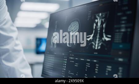 Hôpital médical : le neurologue et le neurochirurgien parlent, utilisent l'ordinateur, analysent l'IRM du patient, diagnostiquent le cerveau. Brain Surgery Health Clinic Lab : deux médecins professionnels regardent la tomodensitométrie. Gros plan Banque D'Images