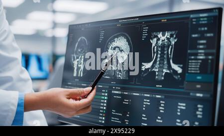 Hôpital médical : le neurologue et le neurochirurgien parlent, utilisent l'ordinateur, analysent l'IRM du patient, diagnostiquent le cerveau. Brain Surgery Health Clinic Lab : deux médecins professionnels regardent la tomodensitométrie. Gros plan Banque D'Images