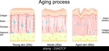 Procédé de vieillissement. Comparaison des peaux jeunes, adultes et âgées. Collagène, élastine, acide hyaluronique et fibroblastes dans les peaux plus jeunes et plus âgées. ch. liée à l'âge Illustration de Vecteur