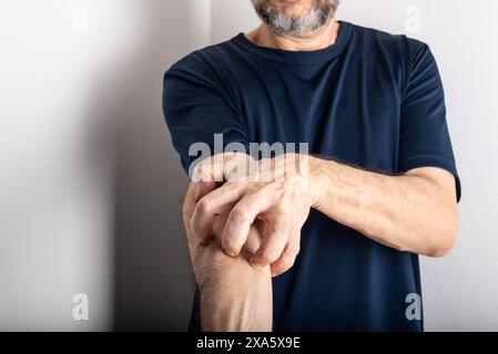 Homme d'âge moyen se grattant l'avant-bras. Maladie de la peau. Soins dermatologiques Banque D'Images