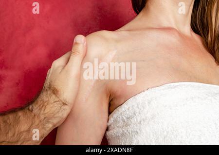 Homme main examine une cicatrice postopératoire sur une épaule de femme. Guérison des cicatrices, traitement des cicatrices sur la peau Banque D'Images