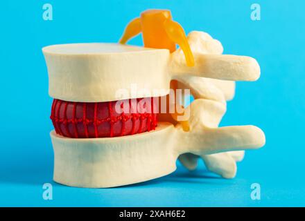 Modèle médical de la colonne vertébrale sur fond bleu, gros plan. Le concept des problèmes et des maladies de la colonne vertébrale, le traitement et la thérapie du mal de dos. Scol Banque D'Images