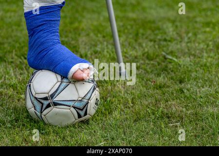 Garçon avec une jambe cassée dans un plâtre pendant un match de football une blessure à un jeune athlète Banque D'Images