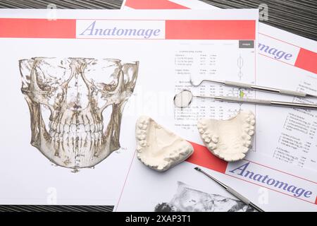 Modèle dentaire avec gencives, cartes anatomiques et outils de dentiste sur table en bois gris, pose à plat. Fonte de dents Banque D'Images