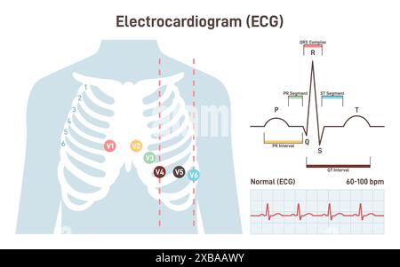 Procédure ECG. Bilan cardio-vasculaire par cardiogramme. Diagnostic des cardiopathies. Illustration vectorielle plate Illustration de Vecteur