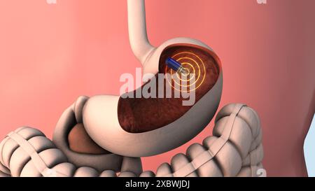 Endoscopie par capsule et communication sans fil Banque D'Images