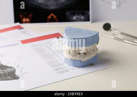 Modèle dentaire avec gencives, cartes anatomiques et radiographie panoramique sur table. Fonte de dents Banque D'Images