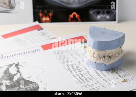 Modèle dentaire avec gencives, cartes anatomiques et radiographie panoramique sur table. Fonte de dents Banque D'Images