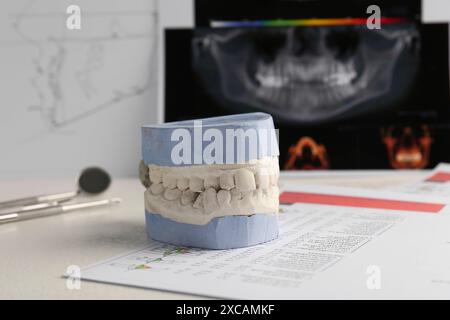Modèle dentaire avec gencives, cartes anatomiques et radiographie panoramique sur table. Fonte de dents Banque D'Images