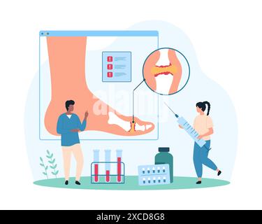 Diagnostic et traitement de la goutte, arthrite inflammatoire des articulations du pied, rhumatologie. Les gens minuscules étudient le tableau médical infographique de la cheville, méfiez-vous de l'illustration vectorielle de dessins animés de cristaux d'acide urique Illustration de Vecteur