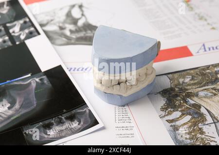 Modèle dentaire avec gencives, cartes anatomiques et radiographie panoramique. Fonte de dents Banque D'Images