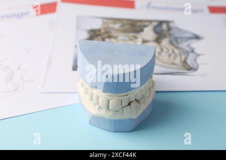 Modèle dentaire avec gencives et graphiques anatomiques sur fond bleu clair, gros plan. Fonte de dents Banque D'Images