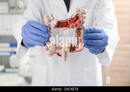 Médecin avec modèle de gros intestin en clinique, foyer sélectif Banque D'Images