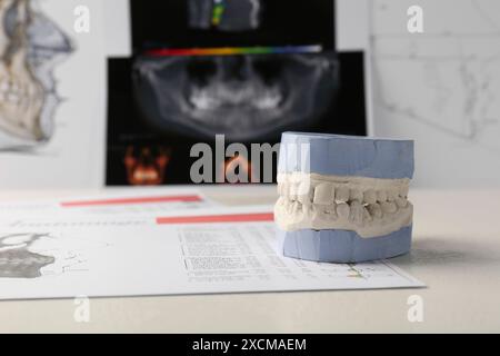 Modèle dentaire avec gencives, cartes anatomiques et radiographie panoramique sur table. Fonte de dents Banque D'Images