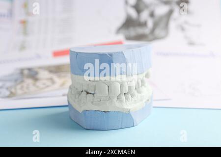 Modèle dentaire avec gencives et graphiques anatomiques sur fond bleu clair, gros plan. Fonte de dents Banque D'Images