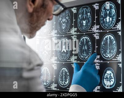 Neurology Research, médecin examinant un scanner cérébral IRM de patients à l'écran Banque D'Images