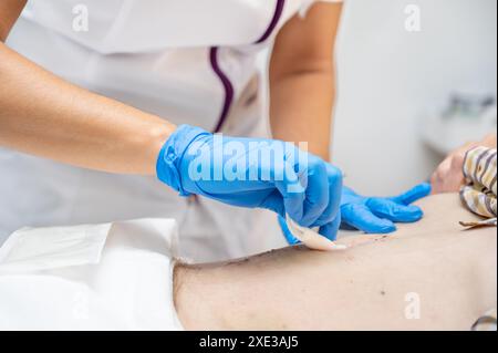 La main du médecin utilise une blessure d'infection de pansement de coton propre à l'abdomen d'un homme. Bandage pour pansement en clinique. médical Banque D'Images