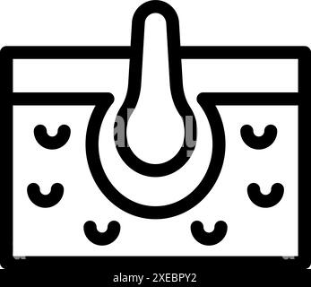 Diagramme montrant les poils poussant de la peau avec follicule visible en coupe transversale Illustration de Vecteur