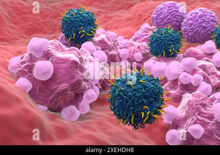 CAR T thérapie cellulaire dans le cancer de l'ovaire - gros plan vue 3D. Banque D'Images