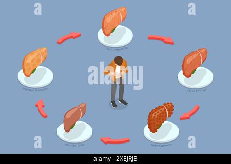 3D Isomtric Flat illustration conceptuelle des étapes des dommages au foie, effet d'une mauvaise nutrition sur le corps humain 3D Isomtric Flat Banque D'Images