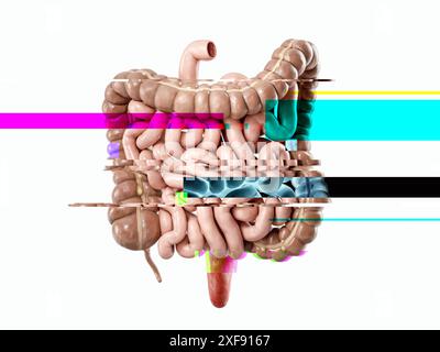 illustration 3d de l'intestin d'organe interne humain, concept d'échec Banque D'Images