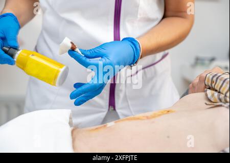 La main du médecin utilise une blessure d'infection de pansement de coton propre à l'abdomen d'un homme. Bandage pour pansement en clinique. soins médicaux soins de santé Banque D'Images