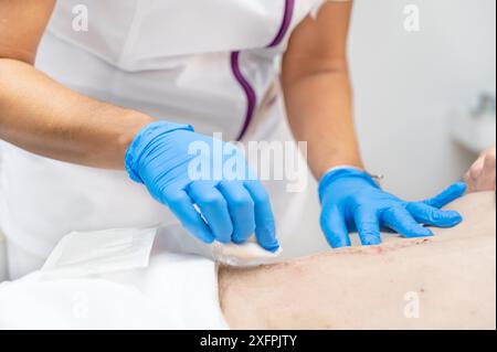 La main du médecin utilise une blessure d'infection de pansement de coton propre à l'abdomen d'un homme. Bandage pour pansement en clinique. soins médicaux soins de santé Banque D'Images