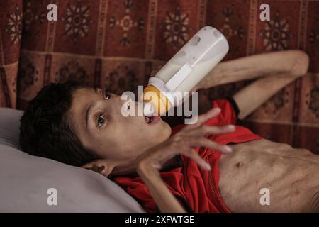 Un garçon palestinien, Ahmed Al-Najjar, 21 ans, souffre de malnutrition et d'atrophie cérébrale Un garçon palestinien, Ahmed Al-Najjar, 21 ans, souffre de malnutrition et d'atrophie cérébrale. Il est allongé sur son lit à l'intérieur d'une tente dans un centre pour abriter les déplacés à Al-Zawaida, dans le centre de la bande de Gaza, le 5 juillet 2024. Al-Najjar, qui pèse 11 kilos, vit avec sa famille dans des conditions de vie difficiles et un manque de nécessités de la vie. Photo de Omar Ashtawy apaimages Al-Zawayda bande de Gaza territoire palestinien 050724 Zawaida OSH 0051 Copyright : xapaimagesxOmarxAshtawyxxapaimagesx Banque D'Images