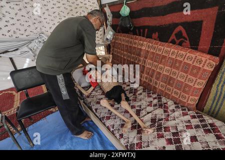 Un garçon palestinien, Ahmed Al-Najjar, 21 ans, souffre de malnutrition et d'atrophie cérébrale Un garçon palestinien, Ahmed Al-Najjar, 21 ans, souffre de malnutrition et d'atrophie cérébrale. Il est allongé sur son lit à l'intérieur d'une tente dans un centre pour abriter les déplacés à Al-Zawaida, dans le centre de la bande de Gaza, le 5 juillet 2024. Al-Najjar, qui pèse 11 kilos, vit avec sa famille dans des conditions de vie difficiles et un manque de nécessités de la vie. Photo de Omar Ashtawy apaimages Al-Zawayda bande de Gaza territoire palestinien 050724 Zawaida OSH 008 Copyright : xapaimagesxOmarxAshtawyxxapaimagesx Banque D'Images