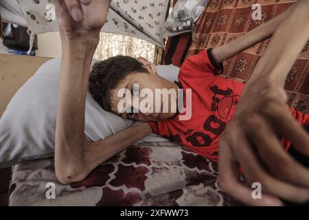 Un garçon palestinien, Ahmed Al-Najjar, 21 ans, souffre de malnutrition et d'atrophie cérébrale Un garçon palestinien, Ahmed Al-Najjar, 21 ans, souffre de malnutrition et d'atrophie cérébrale. Il est allongé sur son lit à l'intérieur d'une tente dans un centre pour abriter les déplacés à Al-Zawaida, dans le centre de la bande de Gaza, le 5 juillet 2024. Al-Najjar, qui pèse 11 kilos, vit avec sa famille dans des conditions de vie difficiles et un manque de nécessités de la vie. Photo de Omar Ashtawy apaimages Al-Zawayda bande de Gaza territoire palestinien 050724 Zawaida OSH 0036 Copyright : xapaimagesxOmarxAshtawyxxapaimagesx Banque D'Images