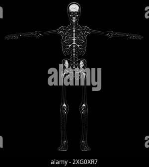 Image radiographique d'un squelette humain avec les bras tendus sur un fond sombre Banque D'Images