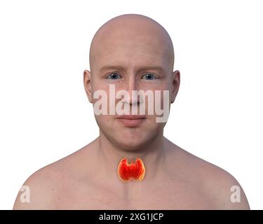 Illustration de la tête, du cou et des épaules d'un homme avec la glande thyroïde mise en évidence. La glande thyroïde produit des hormones qui sont impliquées dans la régulation du métabolisme. Banque D'Images