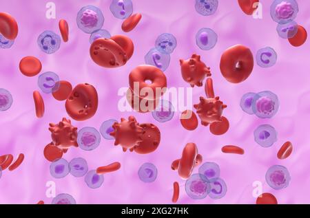 Globules rouges endommagés dans l'hémolyse - vue isométrique illustration 3D. Banque D'Images