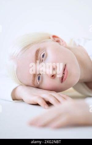 Modèle de fille albinos sur fond blanc de studio. Portrait vertical inclusif de femme. Banque D'Images