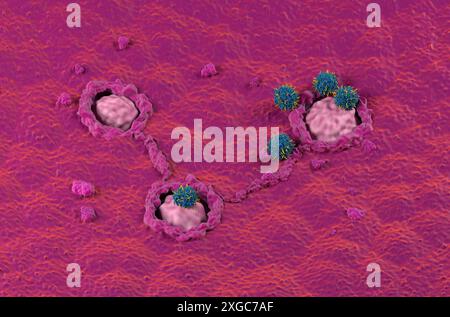 CAR T thérapie de cellules dans le côlon, cancer colorectal (CRC) - vue isométrique illustration 3D. Banque D'Images