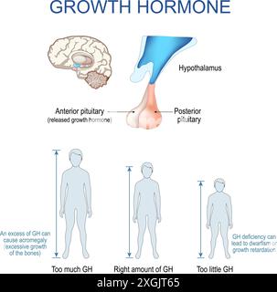 Hormone de croissance. Somatotropine. Gros plan d'un hypothalamus et d'une hypophyse. Hypophyse postérieure et antérieure. Un excès de GH provoque une acromégalie Illustration de Vecteur