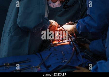 Un groupe de chirurgiens pratiquant une chirurgie cardiaque complexe en salle d'opération stérile Banque D'Images