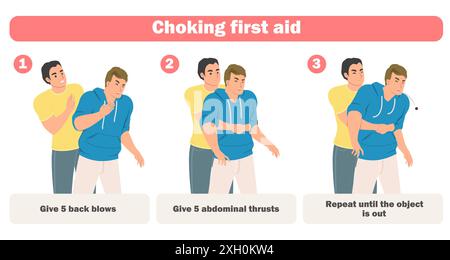 Affiche infographique sur les premiers soins étouffants avec sauvetage des adultes Illustration de Vecteur