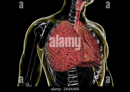 Illustration des poumons touchés par le tabagisme. Banque D'Images