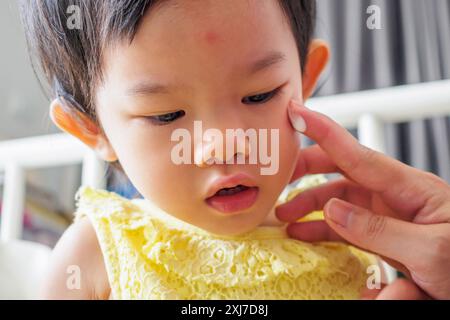 mère appliquant la crème de médecine antiallergique au visage mignon de fille asiatique avec éruption cutanée et allergie avec tache rouge cause par piqûre de moustique Banque D'Images