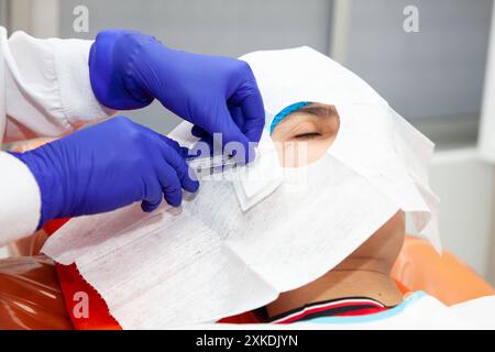 Procédé d'exérèse d'une lésion cutanée. Dermatologue réalisant une ablation d'une lésion cutanée bénigne sur le visage d'un jeune homme. Banque D'Images