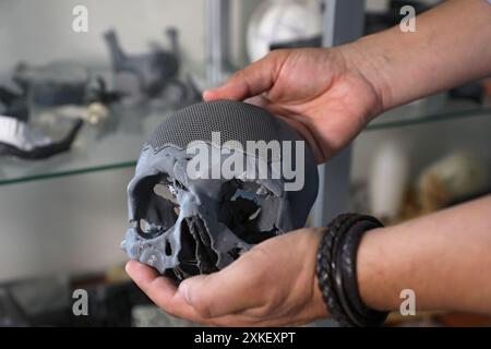 KIEV, UKRAINE - 19 JUILLET 2024 - Danylo Prykhodko, directeur d'IMATEH Medical LLC, montre un implant en titane installé à la place de l'os frontal endommagé sur un modèle de crâne imprimé en 3D d'un patient qui a participé au projet caritatif Doctors for Heroes, Kiev, capitale de l'Ukraine Banque D'Images