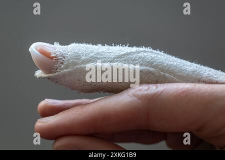 Doigt en maillet, empiler une attelle sur le majeur avec un bandage pour immobiliser la dernière phalange après un traumatisme articulaire Banque D'Images