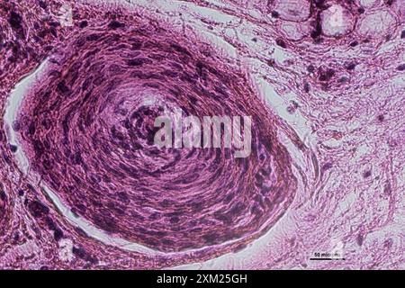Micrographie de la coupe verticale du corpuscule pacinien à 40 tie grossissement Banque D'Images