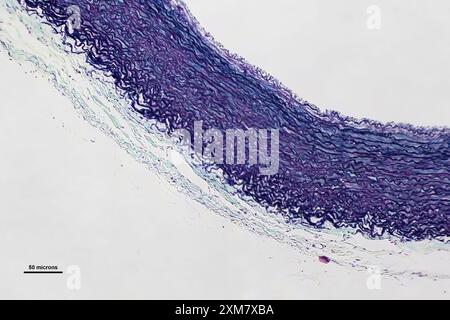 Artère en coupe mince sous microscope optique multipliée par 40 grossissements Banque D'Images